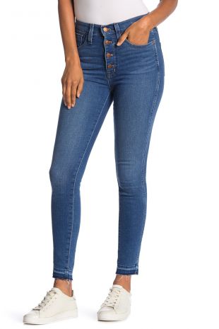 Madewell - Button Skinny Jeans