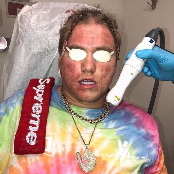 The red stripe Supreme that door Patty on his post Instagram