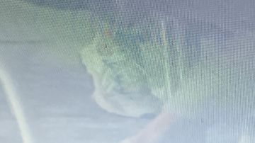 Sneakers Adidas worn by Patrick Blanco (Manu Ríos) in the Elite series